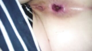Anal Gape her Open